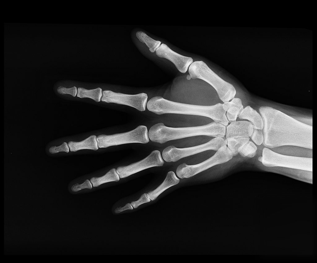 x ray 1.12.2